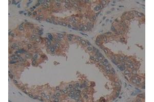 Detection of CX3CL1 in Human Prostate Tissue using Polyclonal Antibody to Chemokine C-X3-C-Motif Ligand 1 (CX3CL1) (CX3CL1 抗体  (AA 25-332))