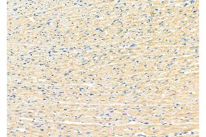 ABIN6265899 and ABIN6273182 at 1/100 staining Rat heart tissue by IHC-P.