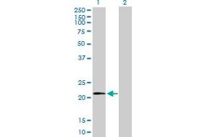 Western Blot analysis of MRPL11 expression in transfected 293T cell line by MRPL11 MaxPab polyclonal antibody. (MRPL11 抗体  (AA 1-192))