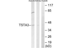 Western blot analysis of extracts from rat kidney cells and rat muscle cells, using TSTA3 antibody. (TSTA3 抗体  (C-Term))