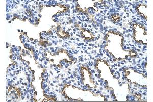 Rabbit Anti-MUC1 Antibody       Paraffin Embedded Tissue:  Human alveolar cell   Cellular Data:  Epithelial cells of renal tubule  Antibody Concentration:   4. (MUC1 抗体  (C-Term))