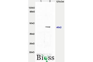 L1 rat brain, L2 human colon carcinoma lysates probed  at 1:3000 90min in 37˚C. (TWIST1, TWIST2 (AA 71-170) 抗体)