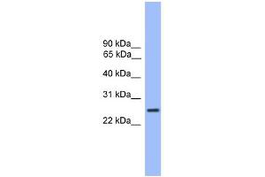 WB Suggested Anti-GOSR1 Antibody Titration: 0. (GS28 抗体  (C-Term))