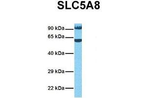 Western Blotting (WB) image for anti-Solute Carrier Family 5 (Iodide Transporter), Member 8 (SLC5A8) (Middle Region) antibody (ABIN2781721)