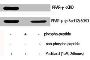 Western Blot analysis of various cells using Phospho-PPAR-γ (S112) Polyclonal Antibody (PPARG 抗体  (pSer112))