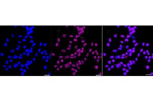 Immunocytochemical staining of HAP-1 cells with GTF2I antibody (ABIN7798709), 1:1,000). (Recombinant GTF2I 抗体)