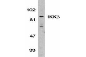 Western blot analysis of IKK beta in Jurkat whole cell lysate with AP30406PU-N IKK beta antibody (C3) at 1/500 dilution. (IKBKB 抗体  (C-Term))