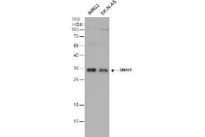 WB Image SNAI1 antibody detects SNAI1 protein by western blot analysis. (SNAIL 抗体)