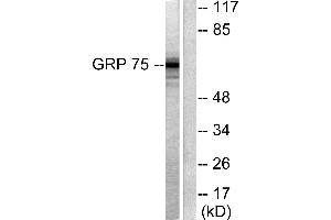 Western blot analysis of extracts from COS7 cells, using GRP75 antibody (#C0216). (HSPA9 抗体)