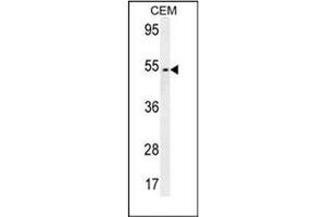 Western blot analysis of FAM46A Antibody (Center) in CEM cell line lysates (35ug/lane). (FAM46A 抗体  (Middle Region))
