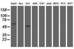 Image no. 2 for anti-Sedoheptulokinase (SHPK) antibody (ABIN1500923) (SHPK 抗体)