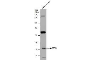 WB Image ACOT8 antibody detects ACOT8 protein by western blot analysis. (ACOT8 抗体)