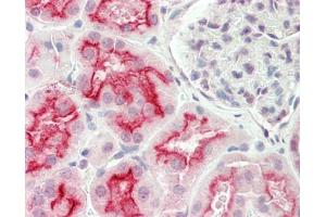 Immunohistochemistry (Paraffin-embedded Sections) (IHC (p)) image for anti-Solute Carrier Family 7 (Amino Acid Transporter Light Chain, Y+L System), Member 7 (Slc7a7) (AA 179-228) antibody (ABIN6756633)