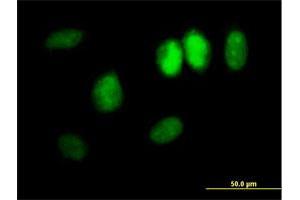 Immunofluorescence of purified MaxPab antibody to DDX11 on HeLa cell. (DDX11 抗体  (AA 1-970))