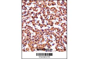 CYP2D6 Antibody immunohistochemistry analysis in formalin fixed and paraffin embedded human liver tissue followed by peroxidase conjugation of the secondary antibody and DAB staining. (CYP2D6 抗体  (N-Term))