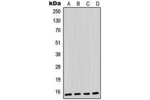 Western blot analysis of Parvalbumin alpha expression in HeLa (A), C6 (B), mouse skeletal muscle (C), rat skeletal muscle (D) whole cell lysates. (PVALB 抗体  (Center))