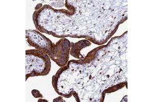 Immunohistochemical staining of human placenta with SPNS1 polyclonal antibody  shows strong cytoplasmic positivity in trophoblastic cells.