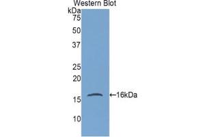 Western blot analysis of the recombinant protein. (Gastrokine 1 抗体  (AA 27-151))