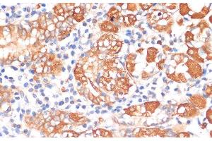 Immunohistochemistry of paraffin-embedded Human stomach using HHLA2 Polyclonal Antibody at dilution of 1:100 (40x lens). (HHLA2 抗体)