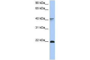 WB Suggested Anti-DLX4 Antibody Titration:  0. (DLX4 抗体  (Middle Region))