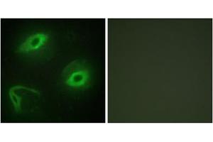 Immunofluorescence analysis of HeLa cells, using LATH antibody. (LATH 抗体  (Internal Region))