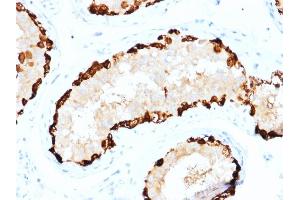 Formalin-fixed, paraffin-embedded human Testis stained with MAGEA4 Mouse Monoclonal Antibody (CPTC-MAGEA4-1). (MAGEA4 抗体)
