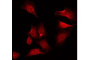 ABIN6272402 staining A549 by IF/ICC. (PSKH1 抗体  (Internal Region))