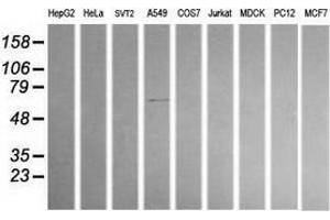Western Blotting (WB) image for anti-Aldehyde Dehydrogenase 1 Family, Member A3 (ALDH1A3) (AA 1-100), (AA 413-512) antibody (ABIN2715888) (ALDH1A3 抗体  (AA 1-100, AA 413-512))