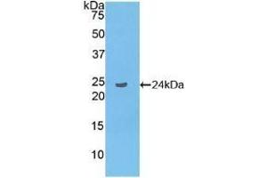 Detection of Recombinant LAT2, Human using Polyclonal Antibody to Linker For Activation Of T-Cells Family, Member 2 (LAT2) (LAT2 抗体  (AA 30-209))