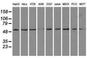 Image no. 4 for anti-ATP Synthase, H+ Transporting, Mitochondrial F1 Complex, beta Polypeptide (ATP5B) antibody (ABIN1496766)