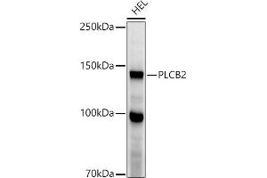 Western blot analysis of extracts of HEL cells, using PLCB2 antibody (ABIN6133052, ABIN6145747, ABIN6145748 and ABIN6224164) at 1:1000 dilution. (Phospholipase C beta 2 抗体  (AA 1-199))
