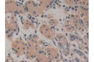 Immunohistochemistry (IHC) image for anti-Amphiregulin (AREG) (AA 20-100) antibody (ABIN7428263)