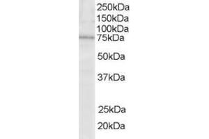 Western Blotting (WB) image for anti-Lymphocyte Cytosolic Protein 2 (SH2 Domain Containing Leukocyte Protein of 76kDa) (LCP2) (N-Term) antibody (ABIN185252)