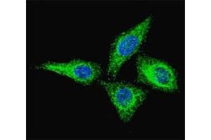 Fluorescent confocal image of HeLa cells stained with anti-Alkaline Phosphatase antibody at 1:100. (Alkaline Phosphatase 抗体  (AA 274-304))