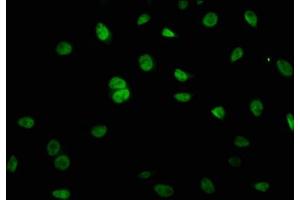 Immunofluorescence staining of A549 cells with ABIN7158687 at 1:66, counter-stained with DAPI. (KRCC1 抗体  (AA 1-259))