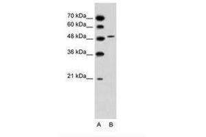 Image no. 2 for anti-Solute Carrier Family 10 (Sodium/bile Acid Cotransporter Family), Member 5 (SLC10A5) (AA 351-400) antibody (ABIN205007) (SLC10A5 抗体  (AA 351-400))