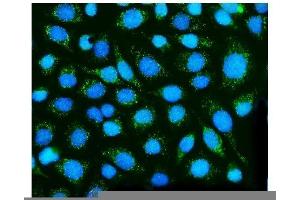 anti-Dysferlin (DYSF) (AA 51-747) antibody