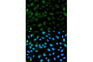 Immunofluorescence analysis of HeLa cell using PML antibody. (PML 抗体)