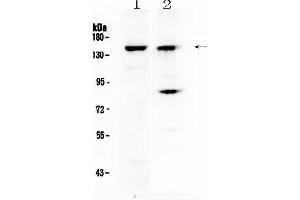 Western blot analysis of FBXL11 using anti-FBXL11 antibody . (KDM2A 抗体)
