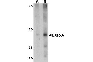 Western Blotting (WB) image for anti-Nuclear Receptor Subfamily 1, Group H, Member 3 (NR1H3) (N-Term) antibody (ABIN1031443) (NR1H3 抗体  (N-Term))