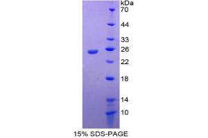 SDS-PAGE analysis of Mouse IL17RE Protein. (IL17RE 蛋白)