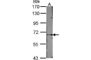 Western Blotting (WB) image for anti-Activin A Receptor Type II-Like 1 (ACVRL1) (Internal Region) antibody (ABIN2855228)
