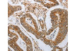 Immunohistochemistry (IHC) image for anti-Neurogenin 1 (NEUROG1) antibody (ABIN6220067) (Neurogenin 1 抗体)