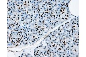 Immunohistochemical staining of paraffin-embedded colon tissue using anti-RPA2mouse monoclonal antibody. (RPA2 抗体)