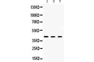 Western blot analysis of AMACR expression in rat kidney extract ( Lane 1), rat liver extract ( Lane 2) and HEPG2 whole cell lysates ( Lane 3). (AMACR 抗体  (Middle Region))