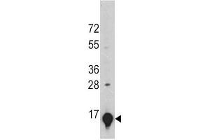 Western Blotting (WB) image for anti-Solute Carrier Family 1 (Glial High Affinity Glutamate Transporter), Member 2 (SLC1A2) antibody (ABIN4910072)