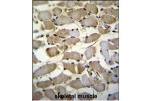 ZMYND17 Antibody (C-term) (ABIN655547 and ABIN2845056) immunohistochemistry analysis in formalin fixed and paraffin embedded human skeletal muscle followed by peroxidase conjugation of the secondary antibody and DAB staining.