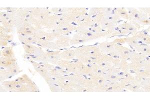 Immunohistochemistry (IHC) image for anti-Lysosomal-Associated Membrane Protein 3 (LAMP3) (AA 222-381) antibody (ABIN7444310)