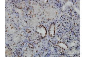 Immunoperoxidase of monoclonal antibody to SGK on formalin-fixed paraffin-embedded human kidney. (SGK1 抗体  (AA 1-90))