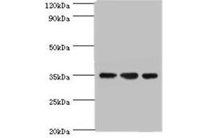 Western blot All lanes: AIMP2 antibody at 5 μg/mL Lane 1: Hela whole cell lysate Lane 2: HepG2 whole cell lysate Lane 3: K562 whole cell lysate Secondary Goat polyclonal to rabbit IgG at 1/10000 dilution Predicted band size: 35 kDa Observed band size: 35 kDa (AIMP2 抗体  (AA 141-320))
